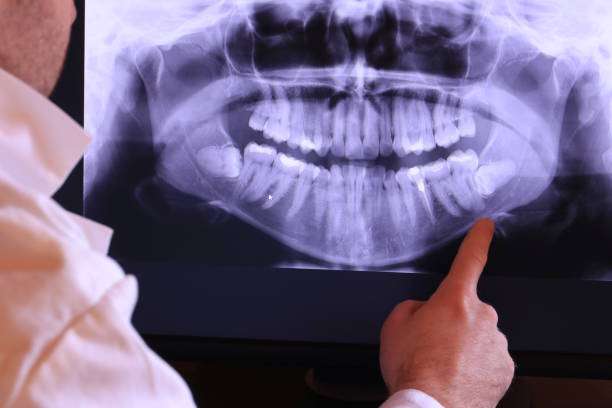 Best Emergency Denture Repair in Creighton, NE