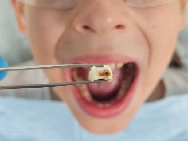 Best Emergency Orthodontic Services in Creighton, NE